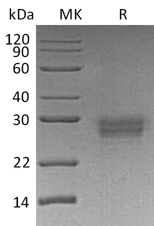 Human CD32b +SDS-PAGE.jpg